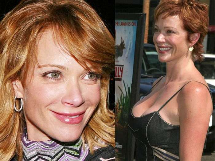 Lauren Holly before after plastic surgery